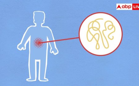 Monsoon Stomach Infection: मानसून में पेट के इंफेक्शन से बचना है तो आज ही बदल लें ये आदतें, डॉक्टरों ने बताए ये आसान उपाय 