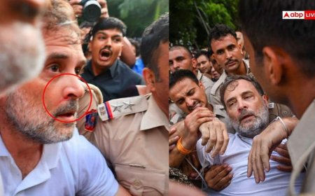नाक से बहा खून, छाती पर चोट..., प्रदर्शन के दौरान राहुल गांधी के घायल होने की आई तस्वीर