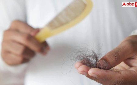 Hair Fall Control: शैंपू से भी नहीं रुक रहा हेयर फॉल? ये 5 'सोया फूड्स' जड़ों से करेंगे मजबूत