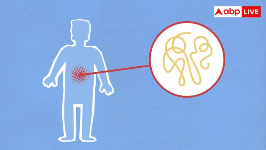 Monsoon Stomach Infection: मानसून में पेट के इंफेक्शन से बचना है तो आज ही बदल लें ये आदतें, डॉक्टरों ने बताए ये आसान उपाय 