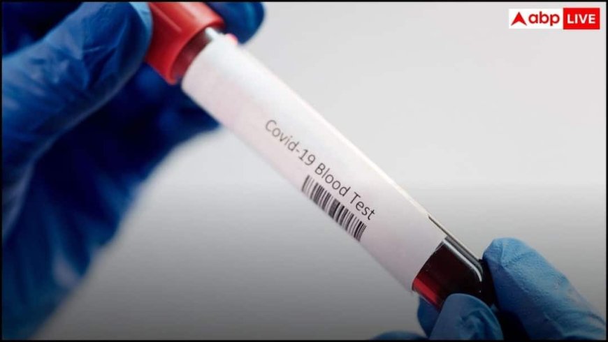 COVID-19 Cases: आंध्र प्रदेश में कोरोना के 12 नए मामले आए सामने, 4 की मौत; स्वास्थ्य विभाग ने कहा- घबराएं नहीं