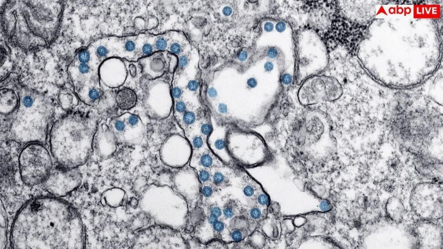 Cyclospora Infection: तेजी से फैल रही यह खतरनाक बीमारी, दिन में 30 बार जाना पड़ रहा टॉयलेट, दवाएं फेल