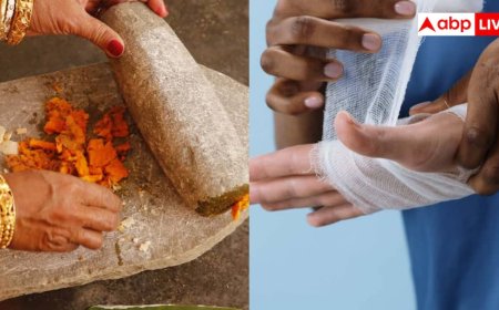 Turmeric For Wounds: हर जख्म के लिए हल्दी का करते हैं इस्तेमाल? ये कितना सही