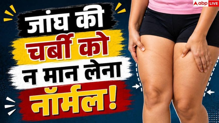 Lipedema Symptoms: जांघ की चर्बी को न मान लेना नॉर्मल फैट, हो सकती है यह बीमारी