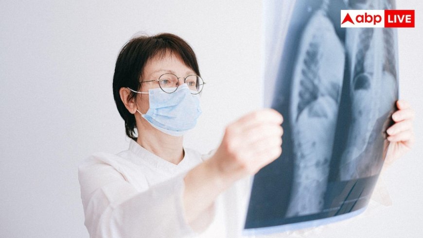  Causes Of Lungs Cancer: हफ्तों पुरानी खांसी और बलगम में खून? जानें फेफड़ों के कैंसर के शुरुआती लक्षण