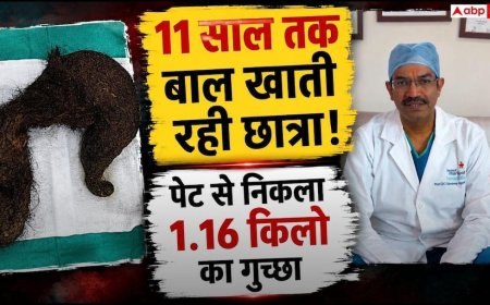 11 साल से अपने बाल खा रही थी छात्रा, पेट से निकला 1.16 किलो का गुच्छा
