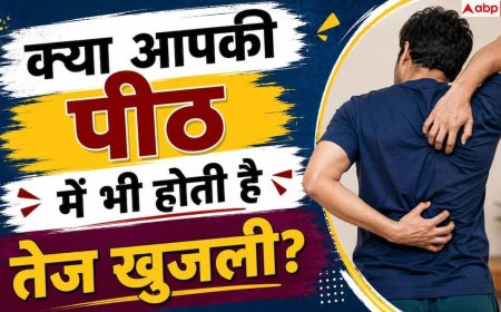 Back Itching: पीठ की खुजली से हैं परेशान? बिना खुजलाए ऐसे पाएं तुरंत आराम