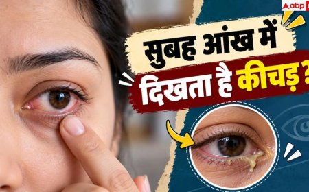 Eye Discharge: सुबह-सुबह आंखों में दिख रहा ज्यादा कीचड़, जानें कब है खतरे का संकेत?