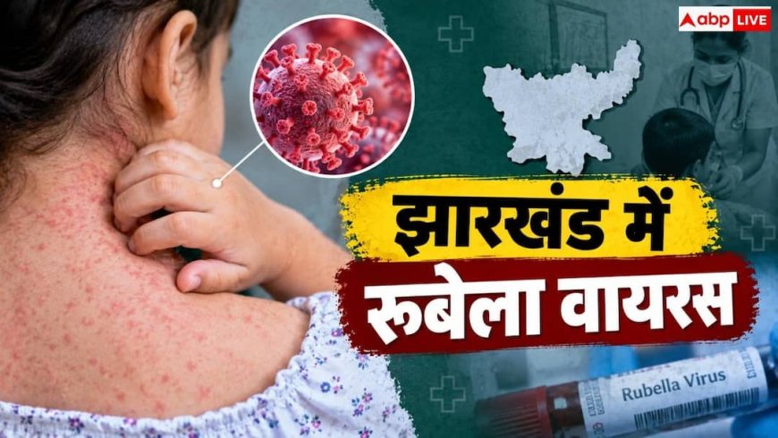 Rubella Virus In Jharkhand: झारखंड में मिला रूबेला वायरस, जानें लक्षण और बचाव का तरीका