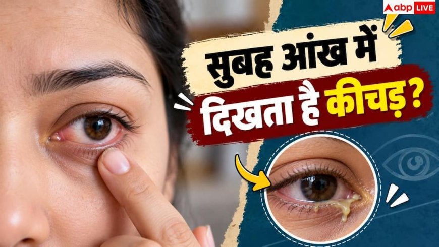 Eye Discharge: सुबह-सुबह आंखों में दिख रहा ज्यादा कीचड़, जानें कब है खतरे का संकेत?