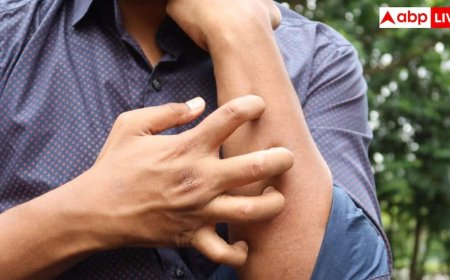 शरीर पर दाद सिर्फ स्किन प्रॉब्लम नहीं, हो सकता है स्ट्रोक और हार्ट अटैक का खतरा!