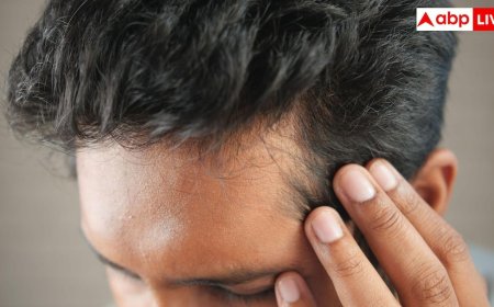 हेयर ट्रांसप्लांट का कर रहे हैं विचार? जानिए क्या हैं इसके साइड इफेक्ट्स