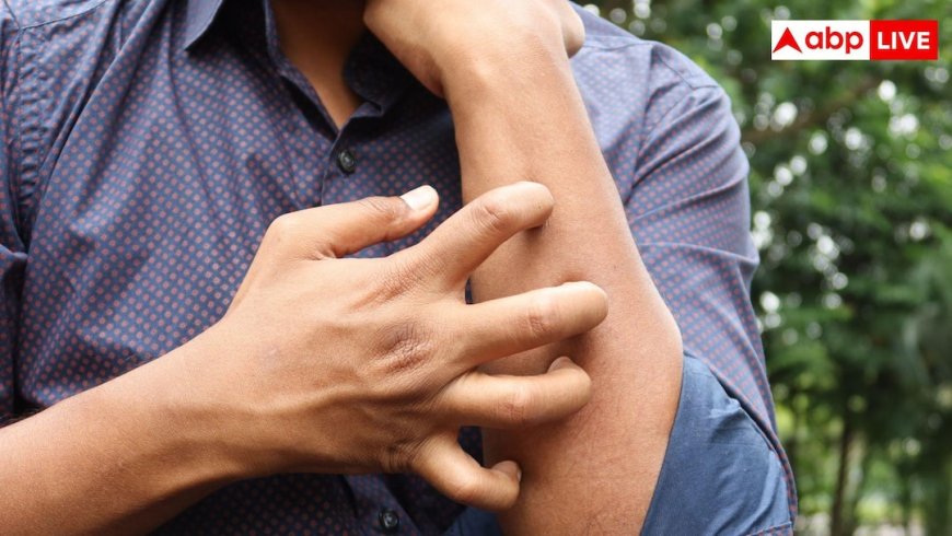 6 हफ्तों से ज्यादा खुजली और चकत्ते? हो सकती है बड़ी बीमारी 